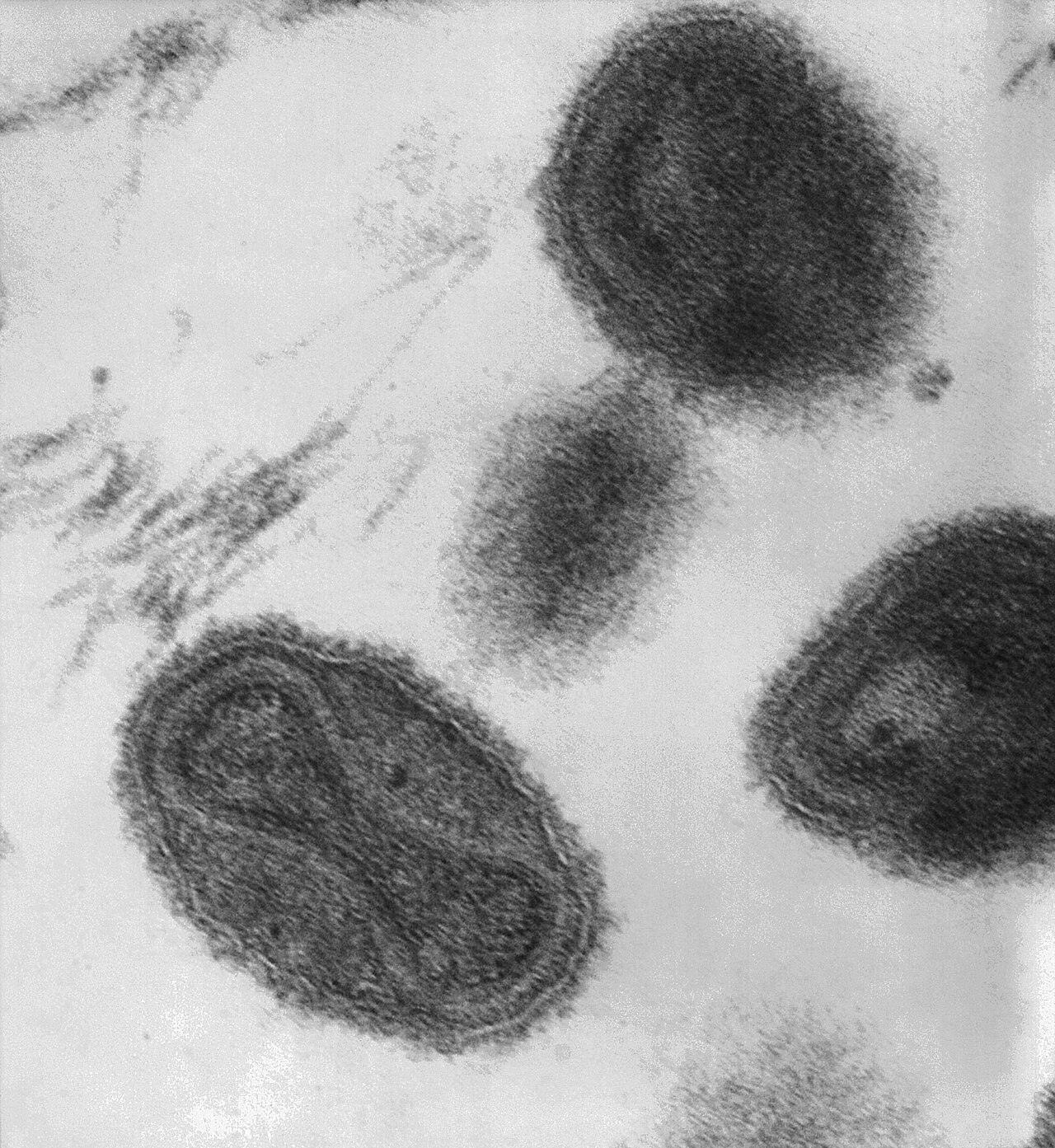 Smallpox virus virions TEM PHIL 1849.JPG
