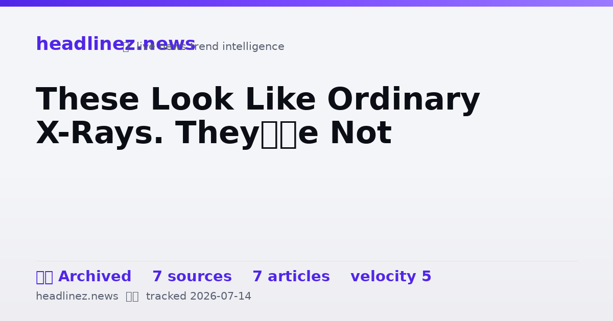 Visual summary for These Look Like Ordinary X-Rays. They’re Not